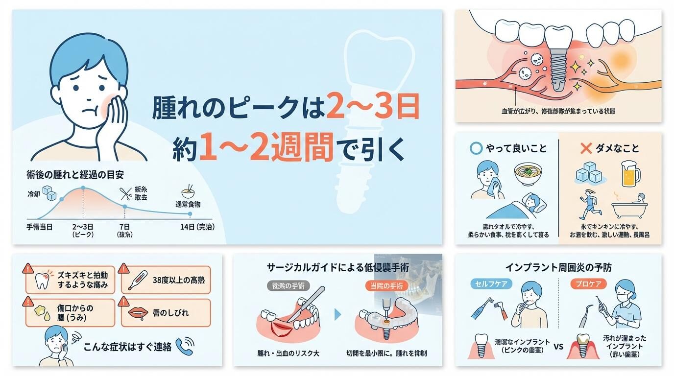 ※バラ売り不可【裁断済み】インプラント周囲炎・疾患　　関連計10冊 書籍詳細「インプラント周囲疾患」 | フォルディネット