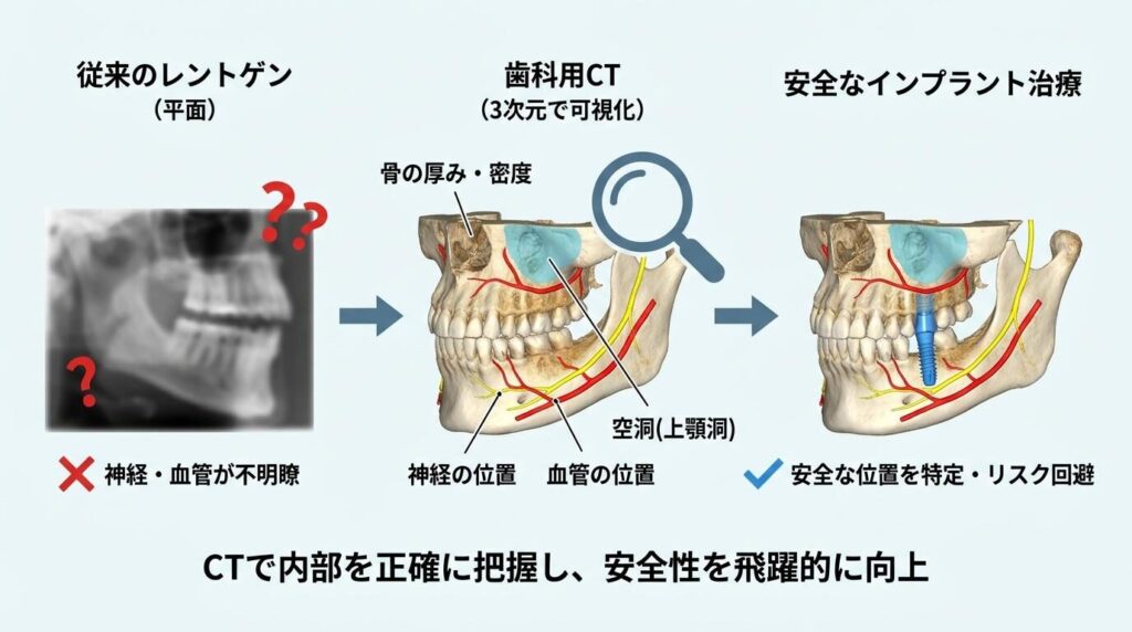 インプラント治療における歯科用CTの役割とは？